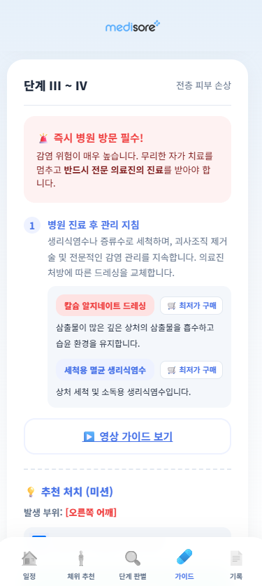 AI 상처 판별 & 처치 가이드